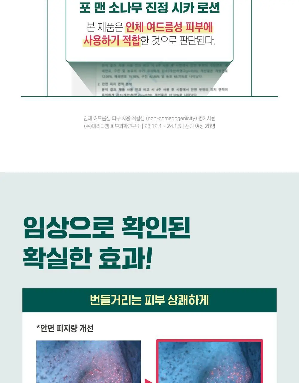 [민감진정/화해1위] 라운드랩 포 맨 소나무 진정 시카 로션 200ml 상세페이지 9